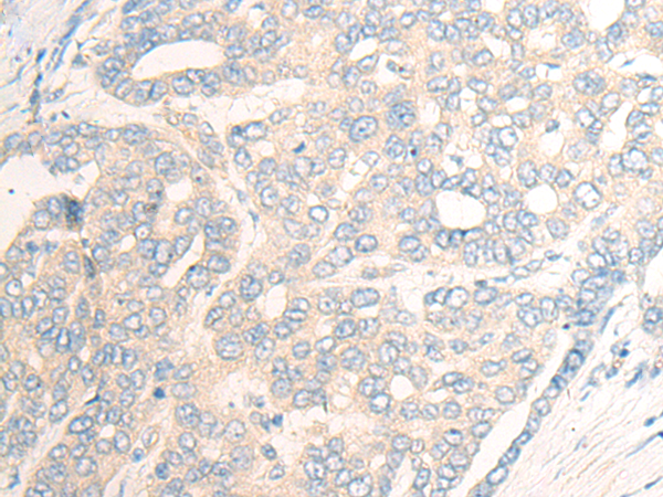 SLC39A4 Antibody