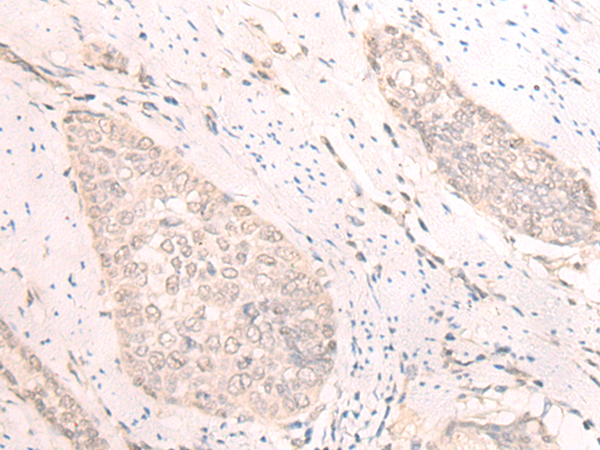 TBC1D2 Antibody