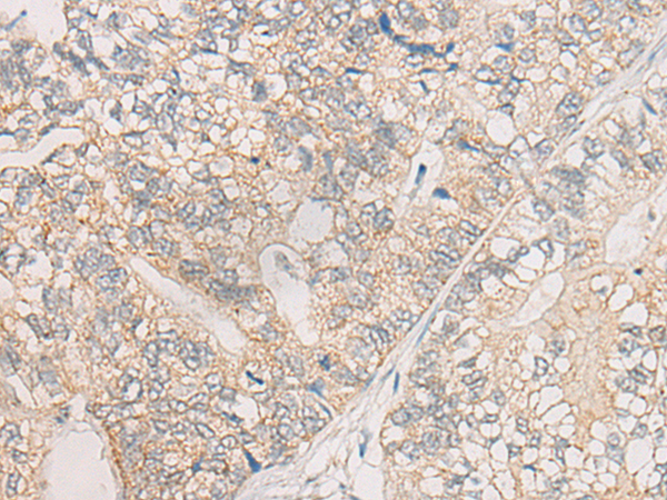 TRAF4 Antibody