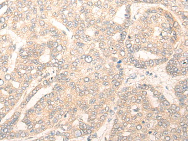 TRIM39 Antibody