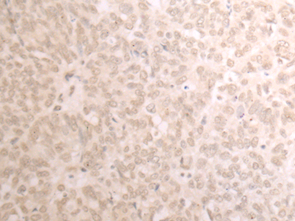 TRMT1 Antibody