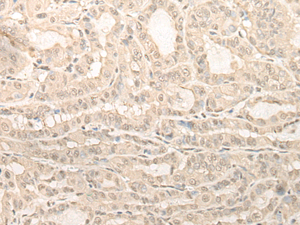 UBXN1 Antibody