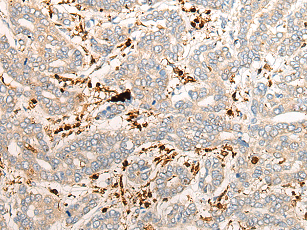 WWTR1 Antibody