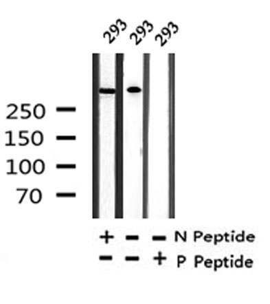 ACC1 (Phospho-Thr1196) Antibody - SAB | Signalway Antibody