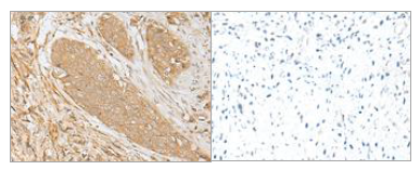 CDH1 Antibody