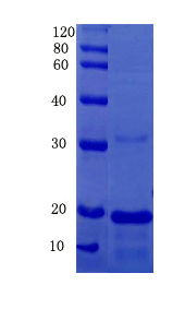 Connective tissue growth factor