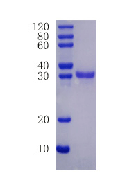 Brain-derived neurotrophic factor