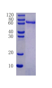 Intercellular adhesion molecule 1