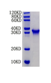 Insulin-like growth factor-binding protein 1