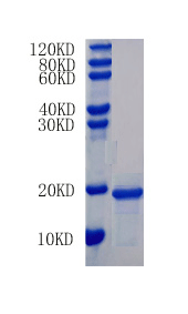 Interleukin-15