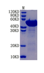 Glial fibrillary acidic protein