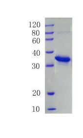 Interleukin-2