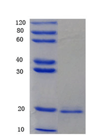 C-C motif chemokine 2