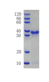 Neurotrophin-3