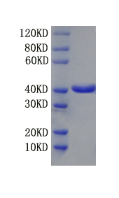 Oncostatin-M