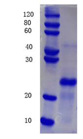 Urokinase-type plasminogen activator