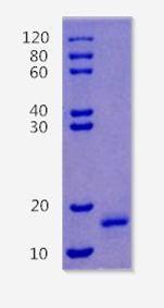 Platelet factor 4