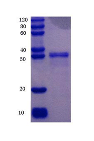 Insulin-like 3