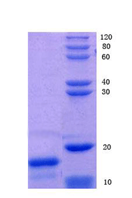 High mobility group protein B1