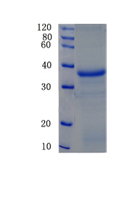 Cathepsin B