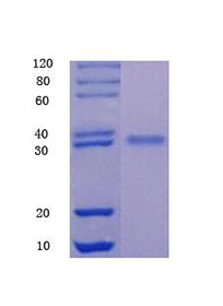 Glycoprotein hormones alpha chain