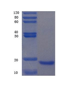 Creatine kinase M-type