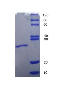 Endothelin-1