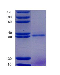 NT-proBNP