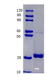 Transcription factor SOX-9