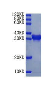 Programmed cell death protein 1