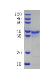 Metalloproteinase inhibitor 1