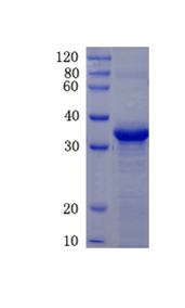 Thyroid peroxidase