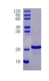 Fatty acid-binding protein, intestinal