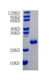 Interleukin-1 beta