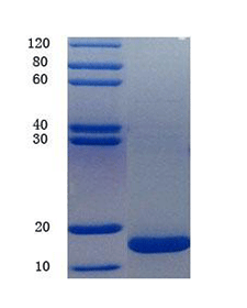 Protein S100-B