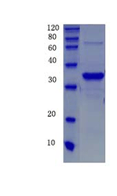 Aquaporin-2