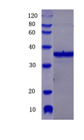 Aquaporin-4