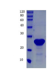 Superoxide dismutase [Cu-Zn]