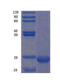 Nicotinamide phosphoribosyltransferase