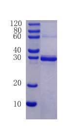 C-C motif chemokine 24