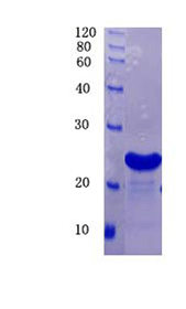 Beta-secretase 1