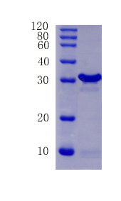 Cyclin-dependent kinase inhibitor 2A, isoforms 1/2/3