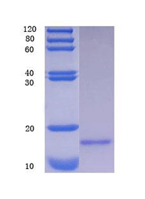 Hypoxia-inducible factor 1-alpha