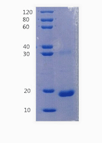 Nitric oxide synthase, inducible