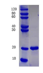 Tumor necrosis factor ligand superfamily member 11