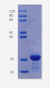 Heat shock 70 kDa protein 1A