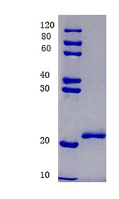 Serum amyloid A-1 protein