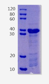 Pulmonary surfactant-associated protein D