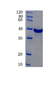 Alpha-synuclein