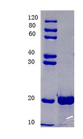 Keratin, type I cytoskeletal 19